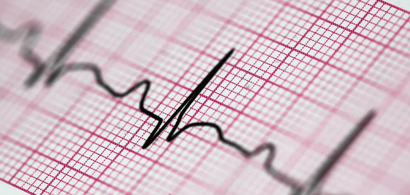 Para que serve o eletrocardiograma e como é feito?