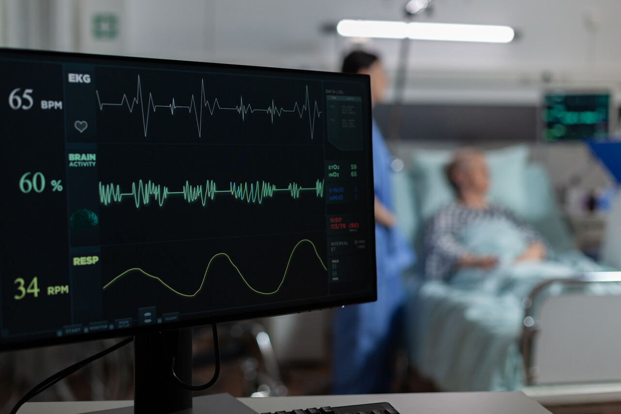Fibrilação Atrial